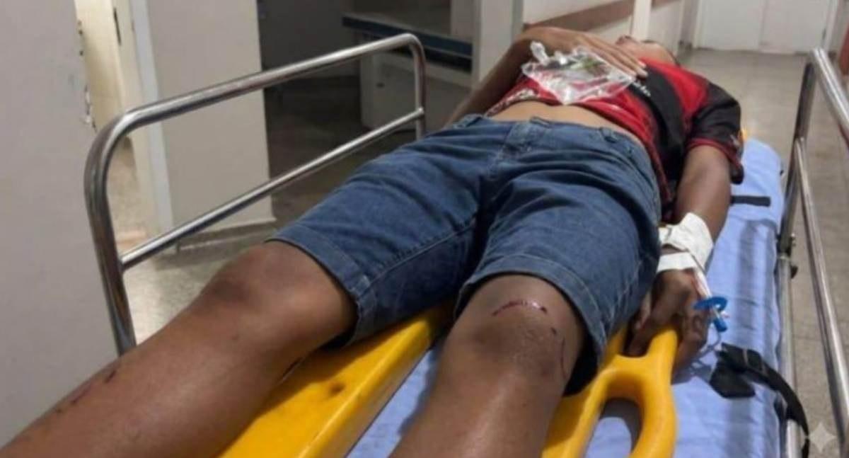 Motociclista fica ferido depois de colidir contra picape no decorrer de manobra na Rua Rondônia